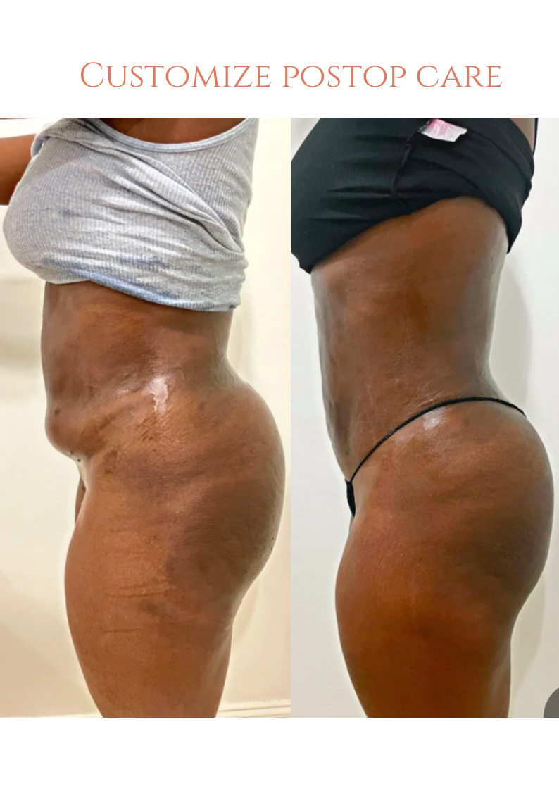 The Importance of Post-Operative Care After Liposuction and Tummy Tuck